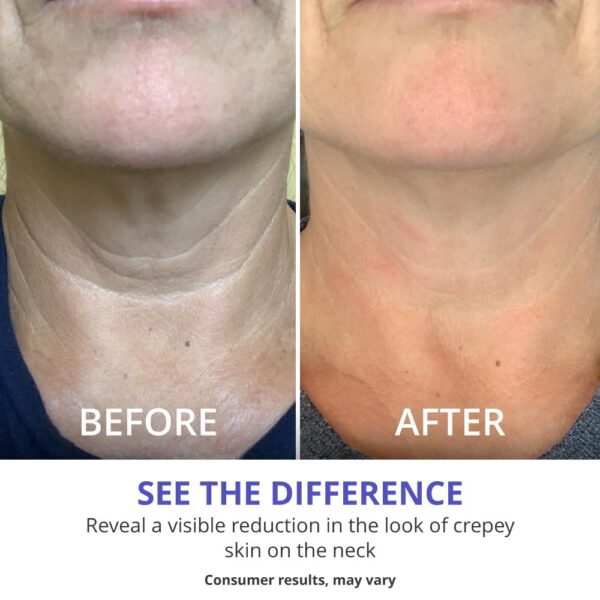goPure Neck Firming Cream - Image 7