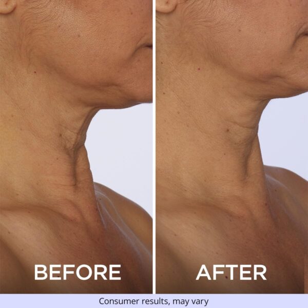 goPure Neck Firming Cream - Image 5